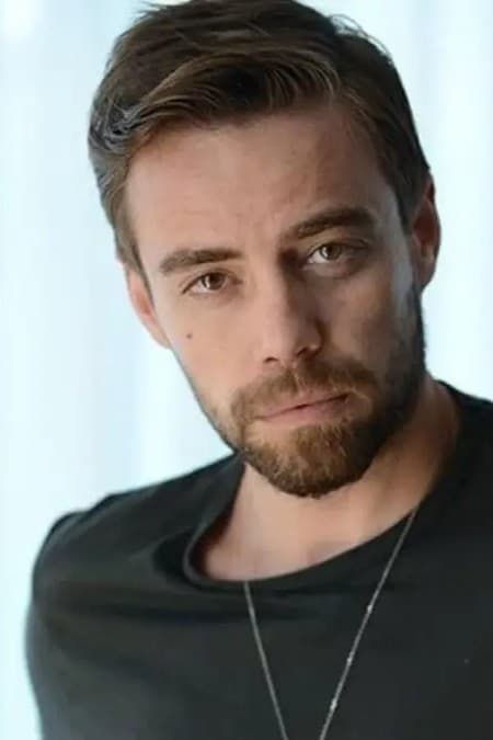 13th Nose Surgery for Turkish Singer Murat Dalkilic | Latest Health Updates